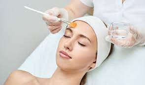 Everything You Should Know About Treatment with Chemical Peels
