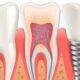 Caring for Your Little One's Smile: The Importance of Pediatric Root Canals