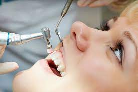 What to Expect During a Dental Cleaning